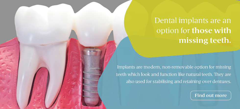 Dental implants are an option for those with missing teeth